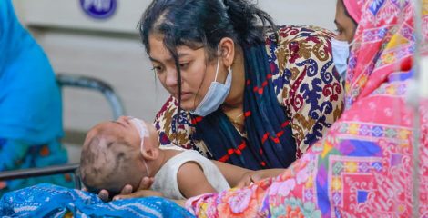 হামের উপসর্গে আরও পাঁচ শিশুর মৃত্যু, আক্রান্ত ৮৭৭